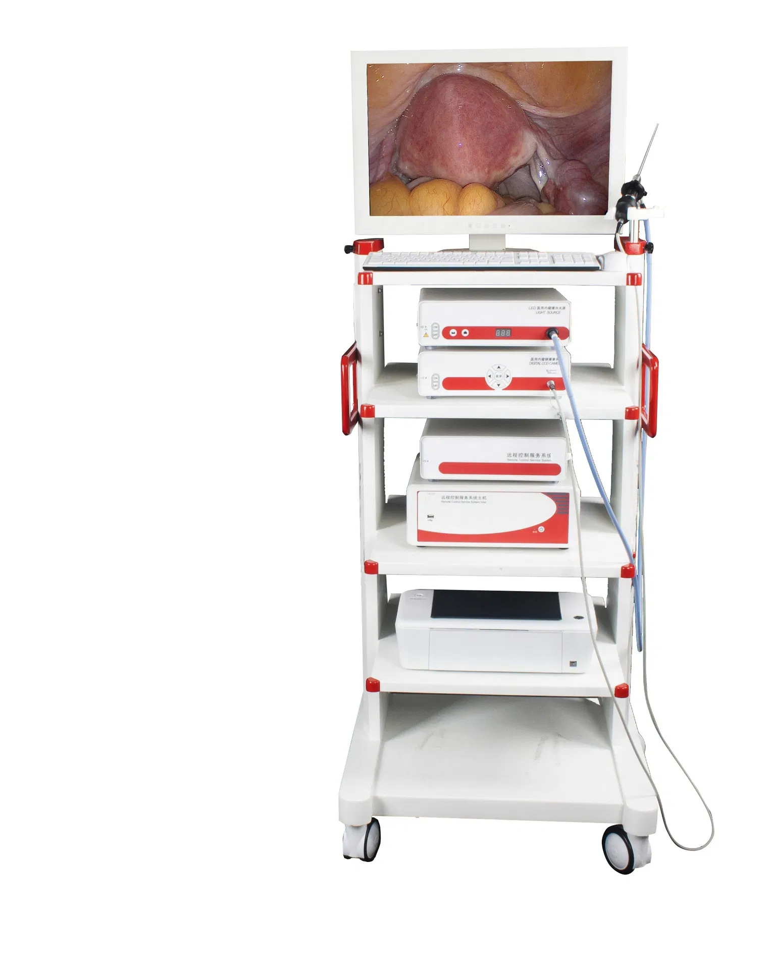 Medical Ent Surgery Endoscope Complete Set Price CE Marked Surgical Instrument for Sale