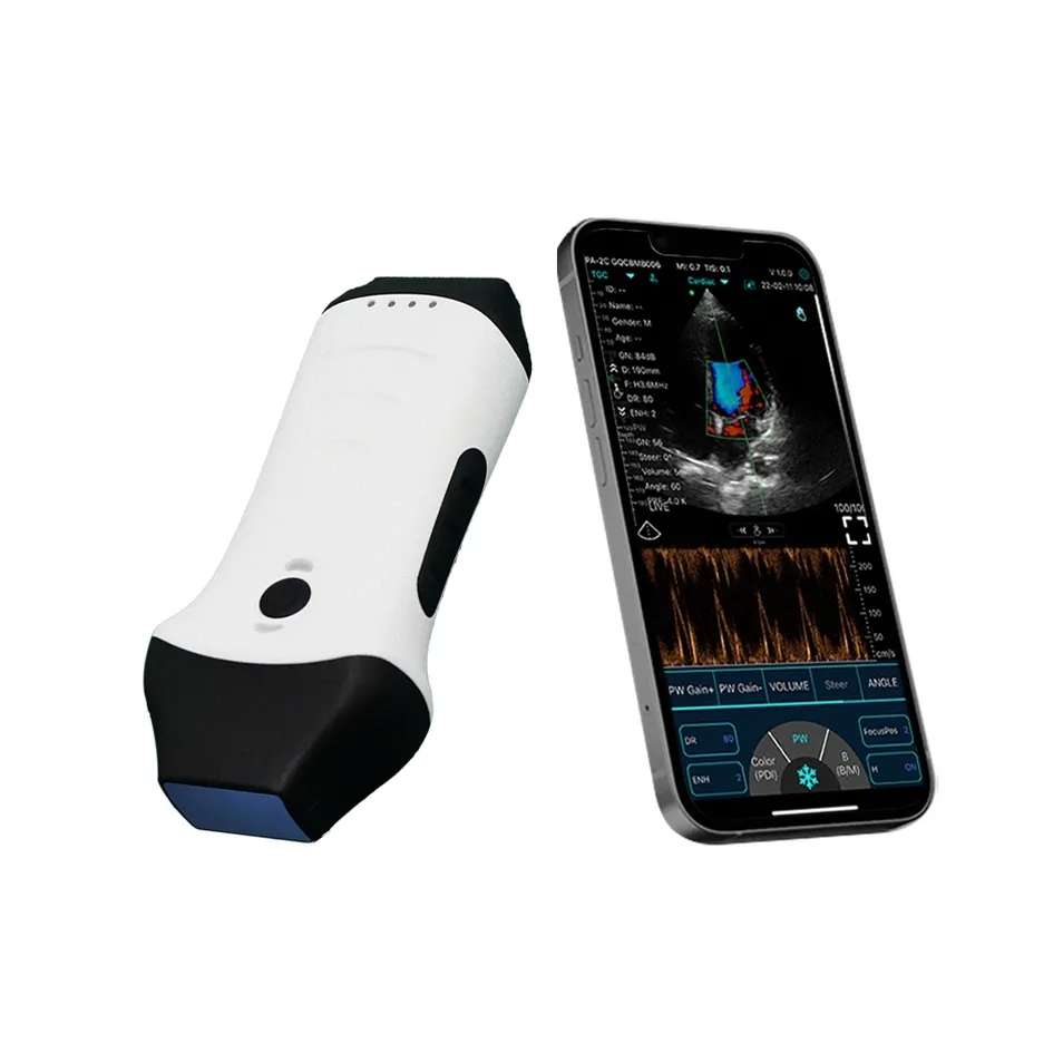 Handheld Ultrasound Device
