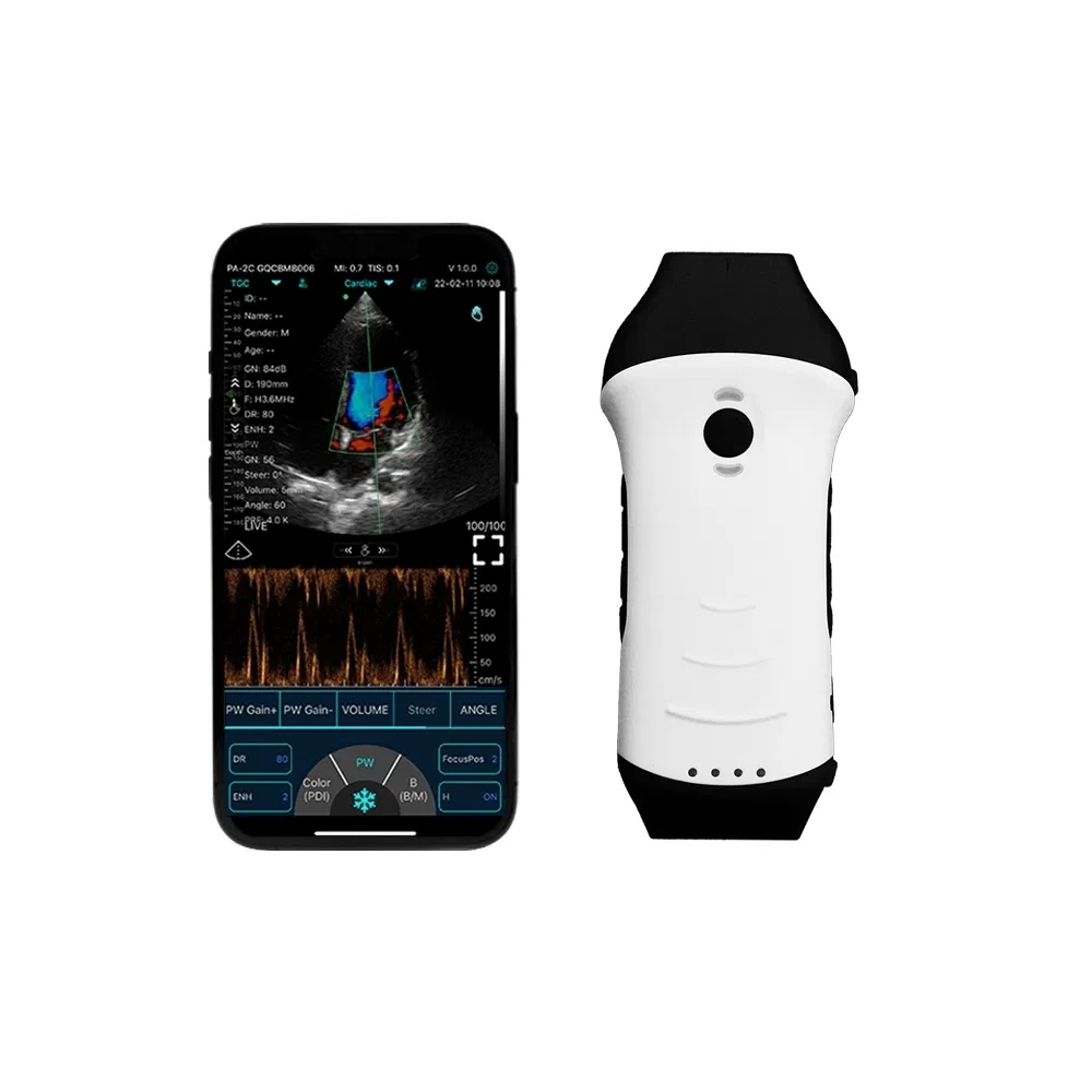 All-in-One Wireless Combination Ultrasound System Handheld Probe for Multi-Organ Clinical Assessment Applications