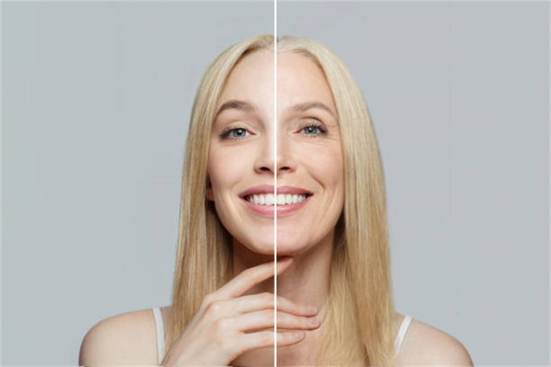 Ergothioneine for skin