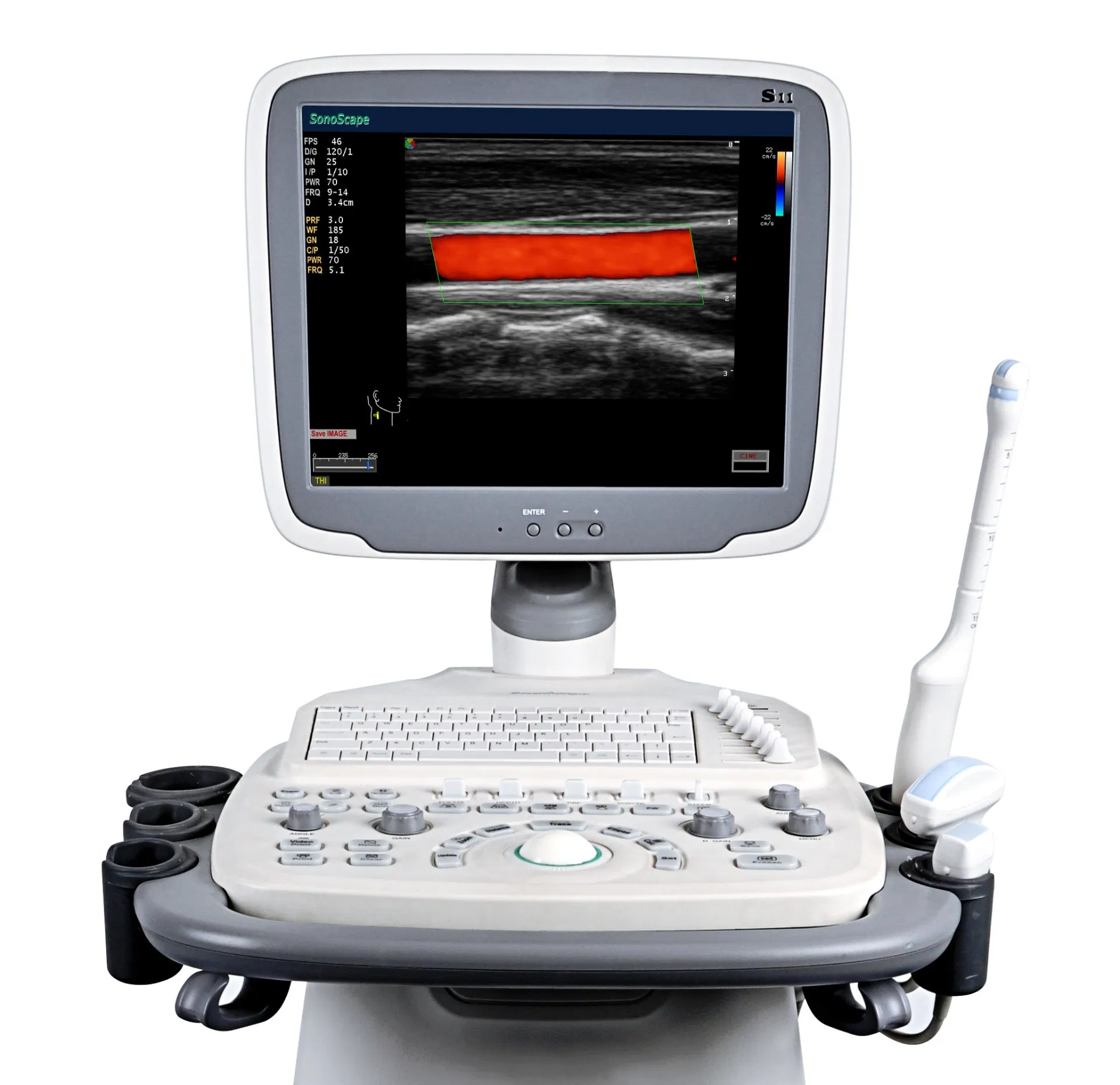 Medical Instrument Trolley Mobile Sonoscape S11 Color Ultrasound