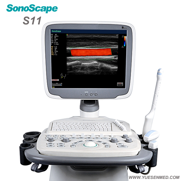 Medical Sonoscape S11 Color Doppler Mobile Ultrasound Machine