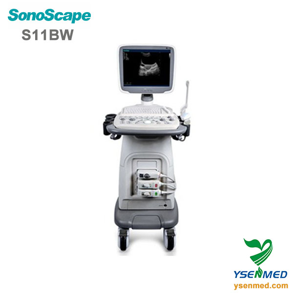 Medical Equipment Sonoscape S11V 4D Color Doppler Ultrasound System