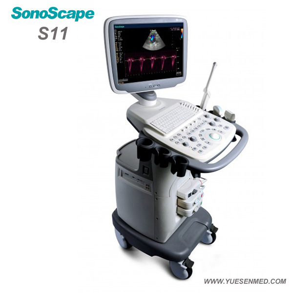 Medical Sonoscape S11 Color Doppler Mobile Ultrasound Machine
