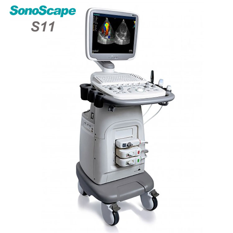 Sonoscape S11 Trolley Type Colour Doppler Ultrasound Machine 4D 3D