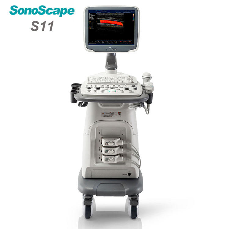 Sonoscape S11 Trolley Type Colour Doppler Ultrasound Machine 4D 3D