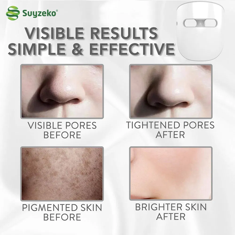 Suyzeko Resale LED Acne Treatment Skin Beauty Equipment