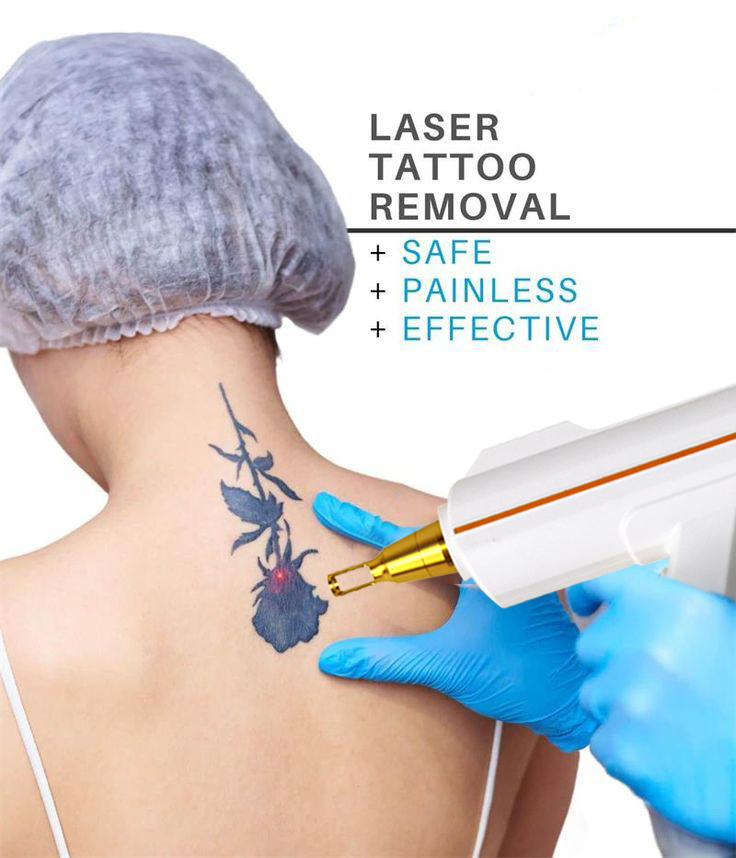 ND YAG Laser Tattoo Removal Machine 1064nm 532nm Adjustable 1-10Hz Pigmentation Removal Carbon Peeling Beauty Equipment
