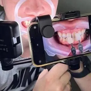 Dental Flash Light 1