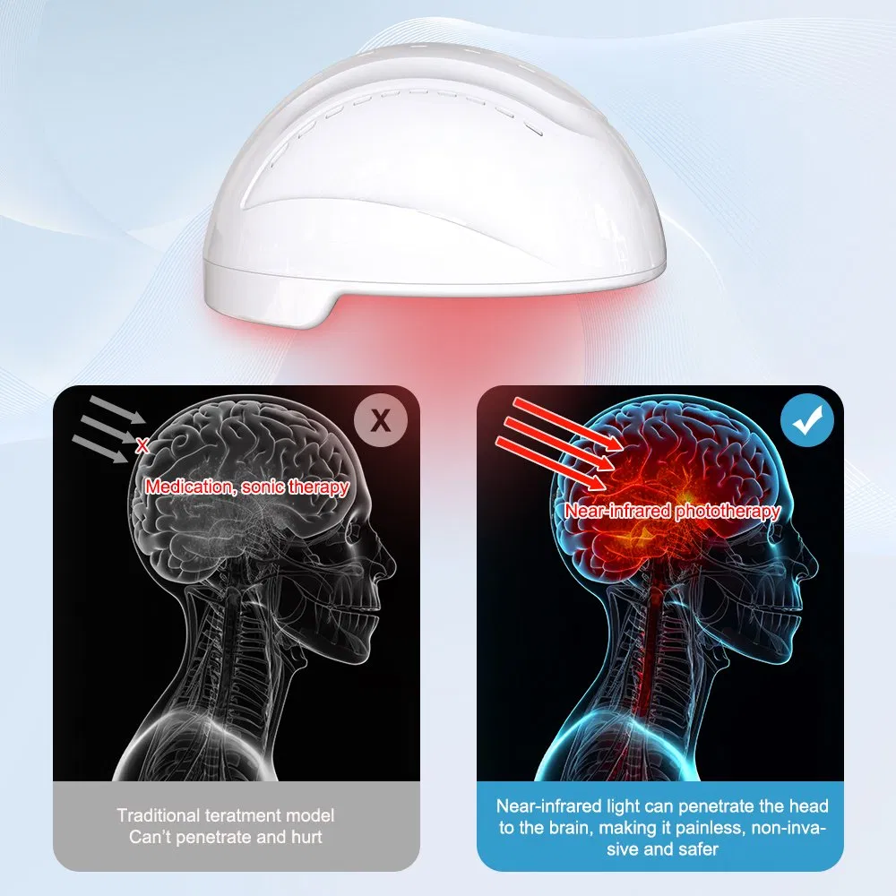 Suyzeko Brain Photobiomodulation Helmet for Enhance Cognitive Function and Memory