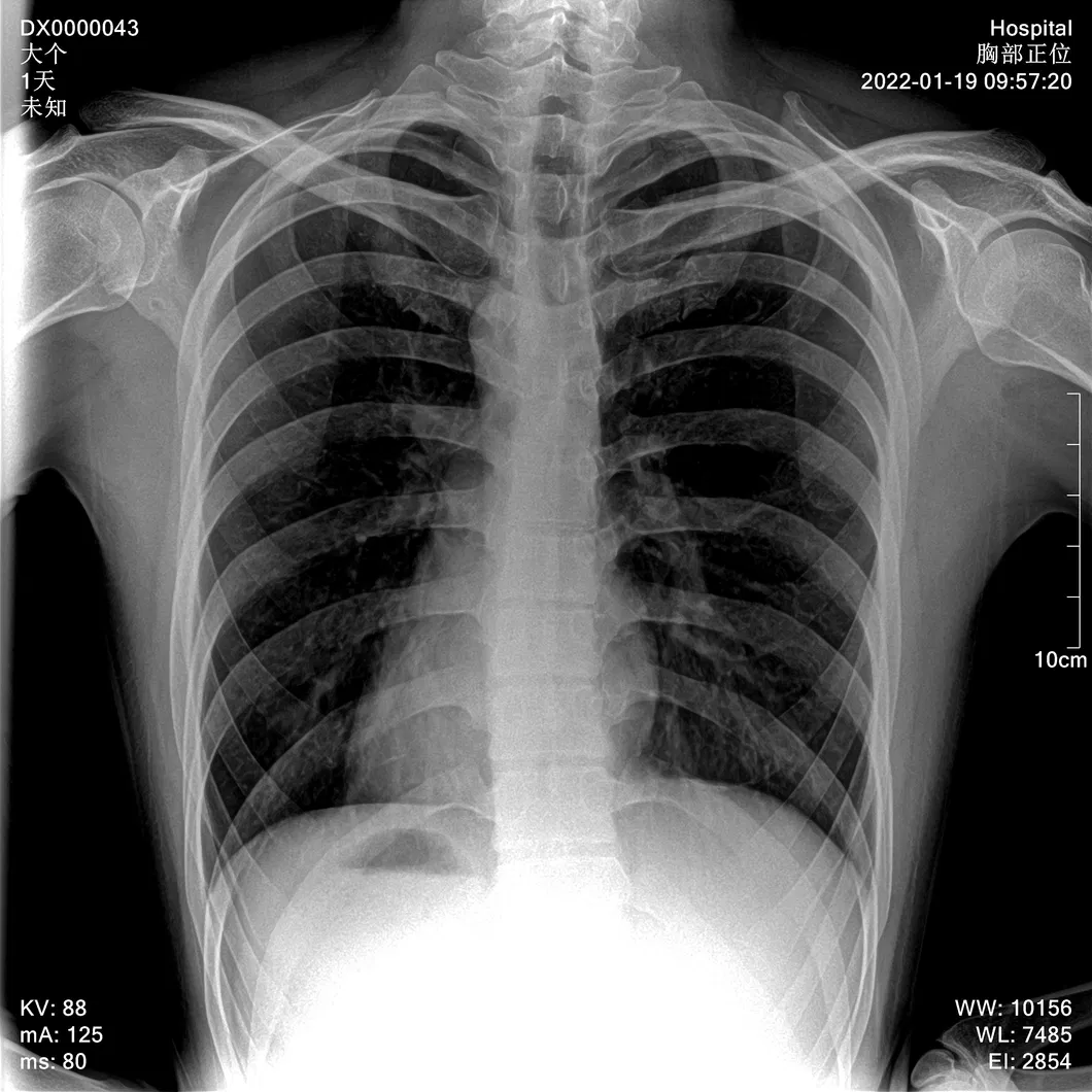 X-ray View 6