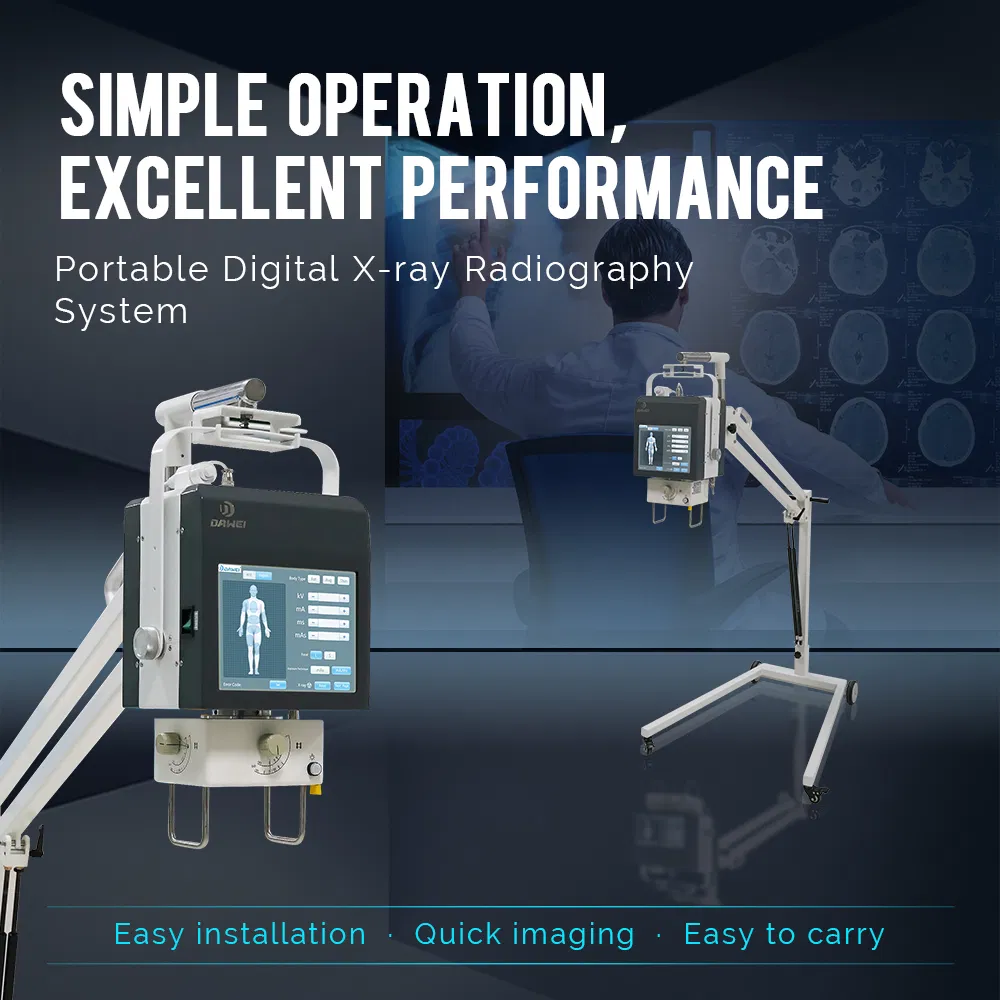 Revolutionize Healthcare with The Ultimate Portable Digital X-ray Machine