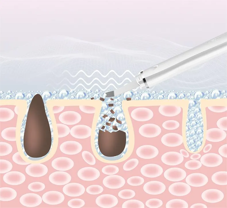 Wholesale Skin Care Blackhead Remover Ultrasonic Skin Scrubber Deep Face Cleaning Face Scrubber