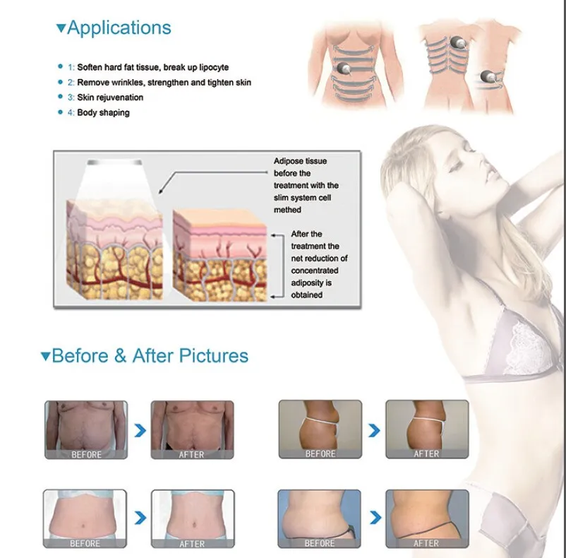 Before and After Results