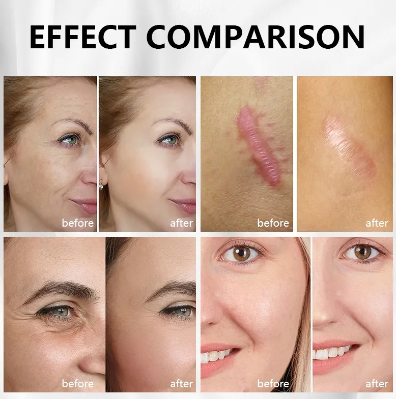 Before and After