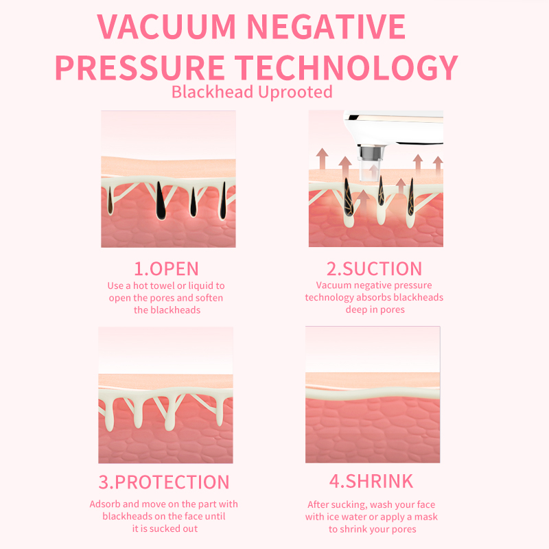 Electric Blackhead Remover Vacuum Description