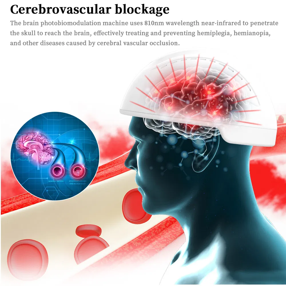 Brain Injury Stroke Headaches Anxiety Depression Red Light Therapy LED Device