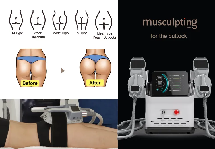 Facial Lift Tecar Therapy Physio Lose Weight 448K Weight Loss Tecar Therapy RF Pain Relief Indeeplus Machine