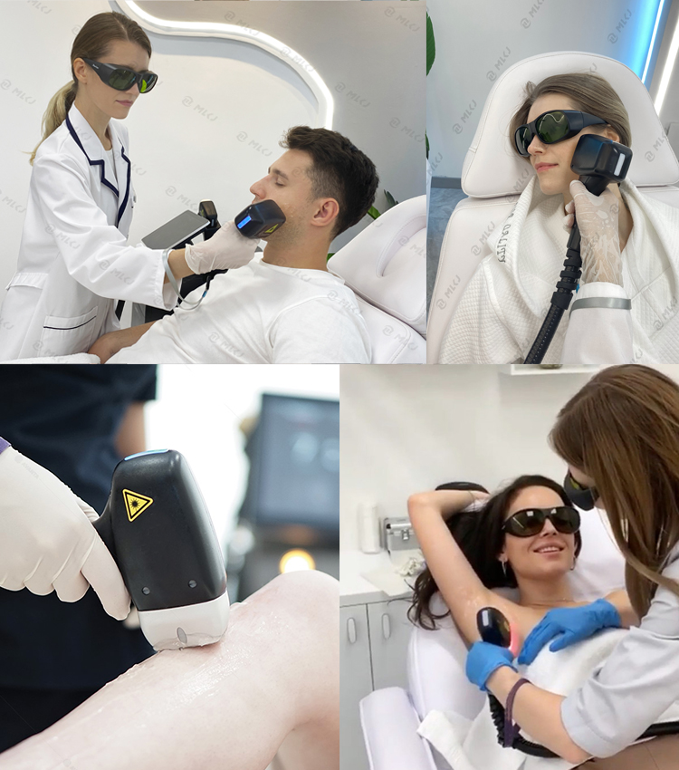 2026 4K Professional Diode Laser Hair Removal Diode Laser 755nm 808nm 1064nm Permanent 808 Diode Laser Hair Removal Machine