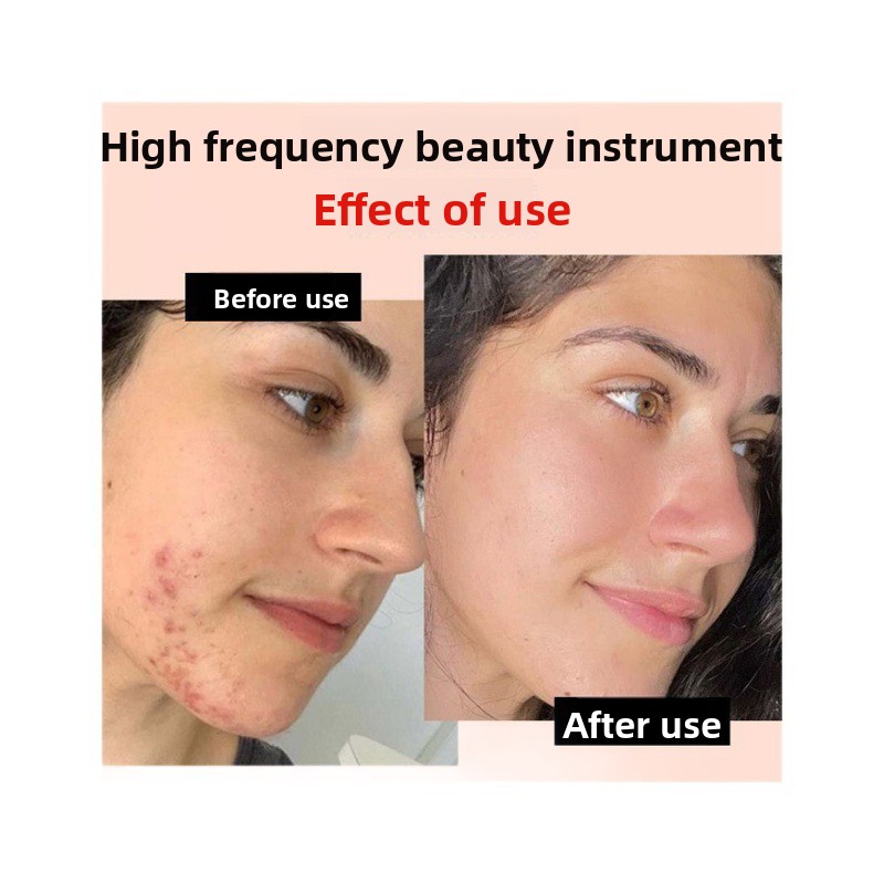 High Frequency Wand Image 9