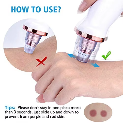Hot Sale Blackhead Remover Pore Vacuum Cleaner With 5 Probes Electric USB Rechargeable Acne Comedone Whitehead Extractor