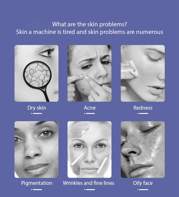 10-in-1 Oxygen Jet Peel Beauty Machine Side View and Operations