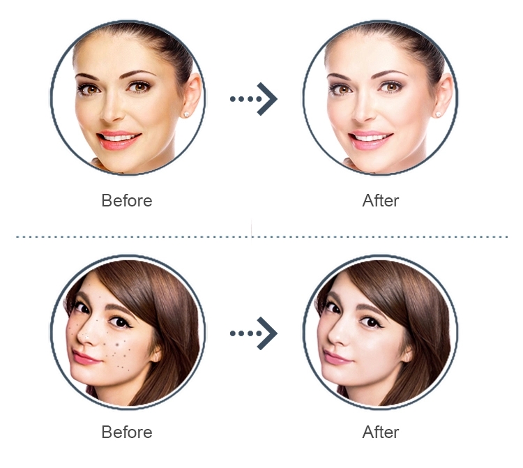 Facial treatment image 5