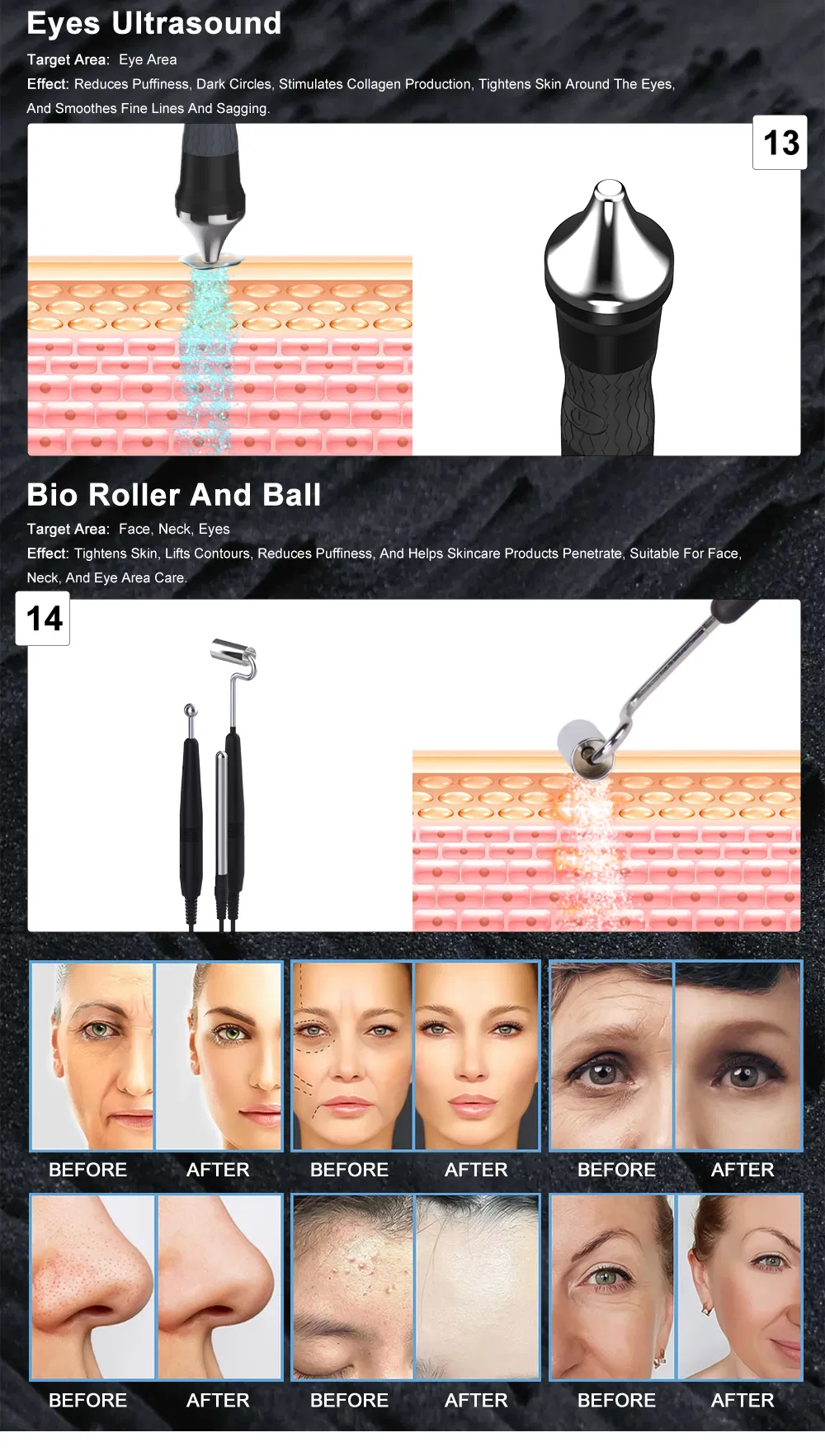Clinical RF Treatment Details