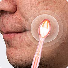 Tongue Tube