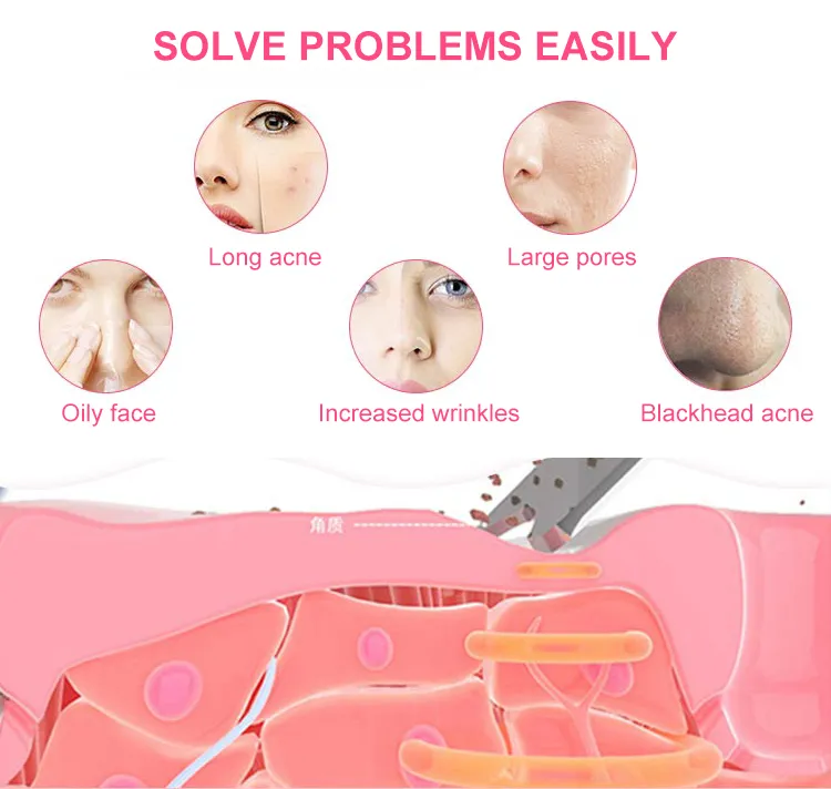 in Stock Smart Facial Cleansing Ultrasonic Skin Scrubber