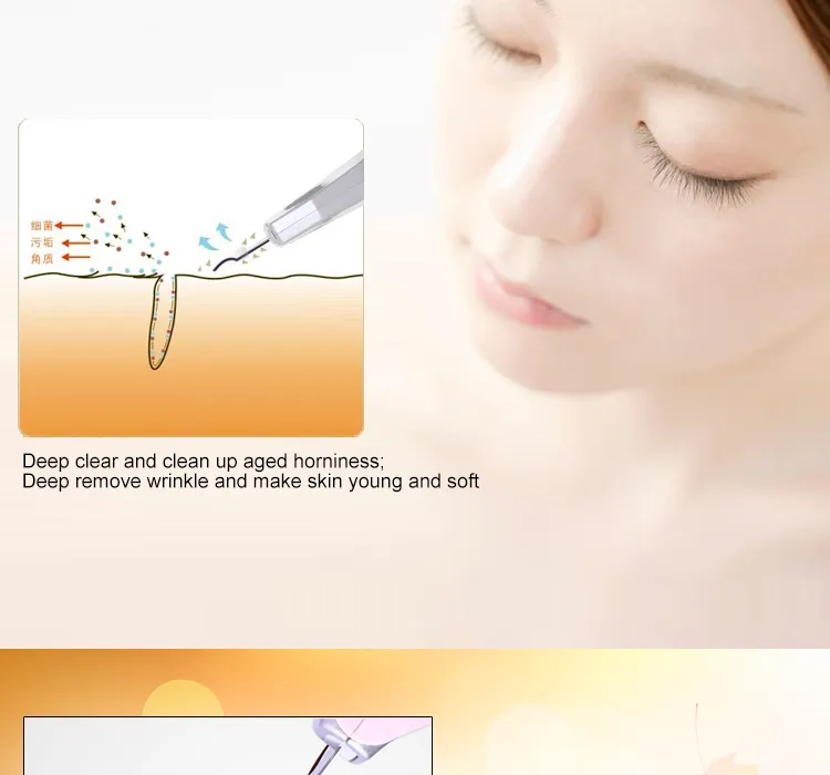 Skin Rejuvenation EMS Ultrasonic Ion Skin Scrubber for Face Cleaning