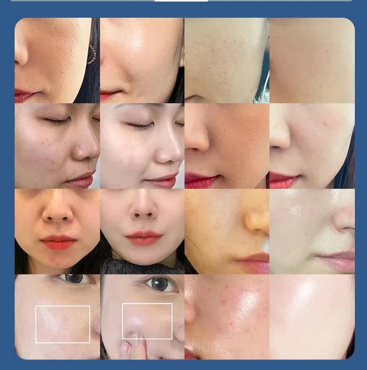 Treatment Effect 1