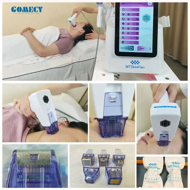 RF Face Lifting Machine Radio Frequency Microneedling Fractional RF Facial Device