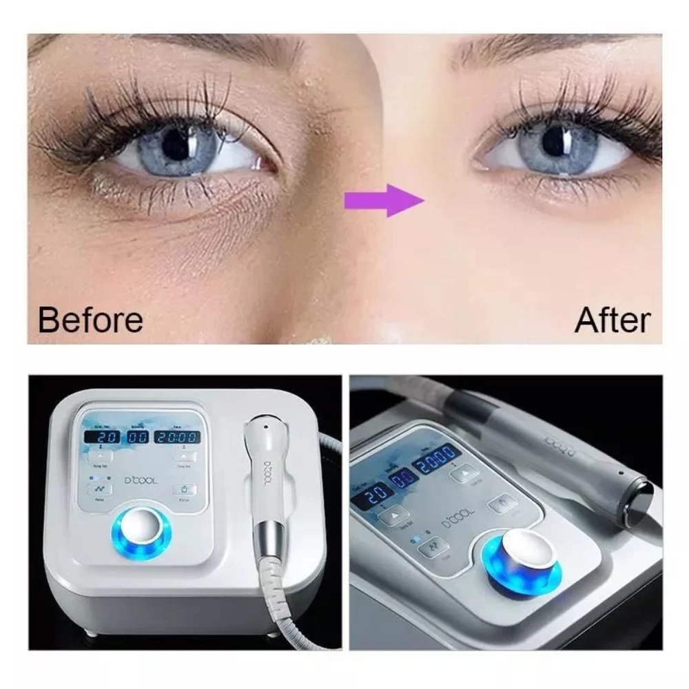 Face Rejuvenation Cryo-Electroporation Device Cryo-Facial D Cool for Skin Brightening Shrinking Pores Skin Care D Cool