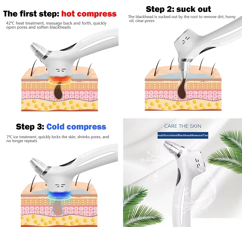 High Quality USB Facial Home Use Blackhead Extractor Remover Pore Vacuum Rechargeable with 5 Suction Heads Made of Plastic