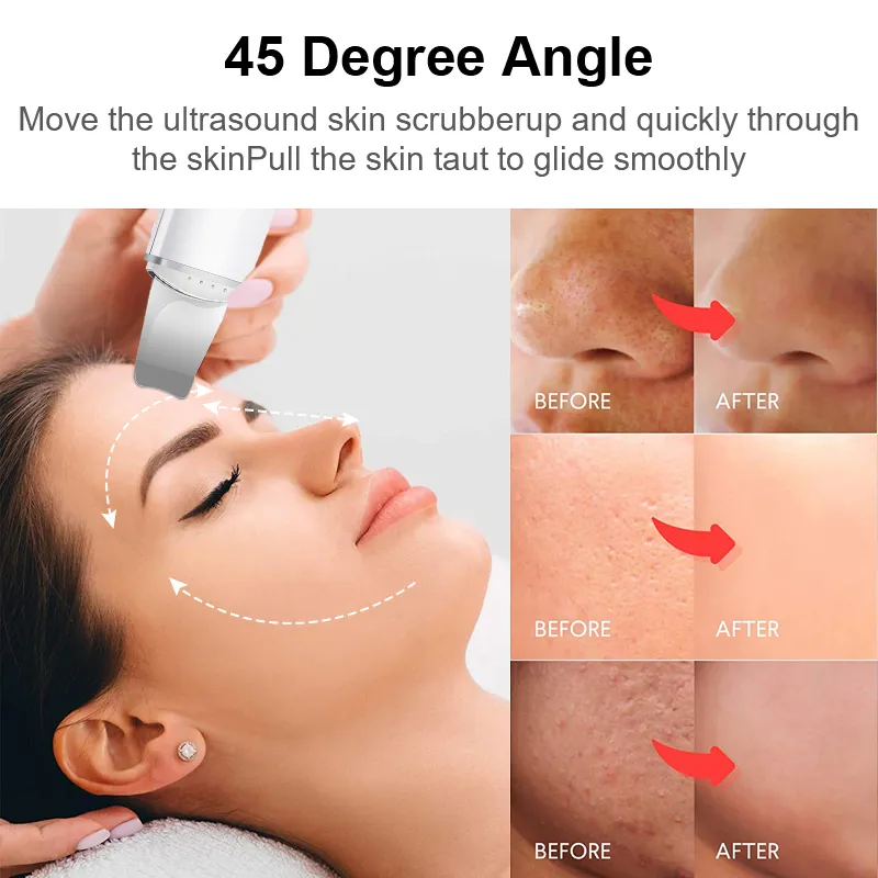 Skin Scrubber Image 4