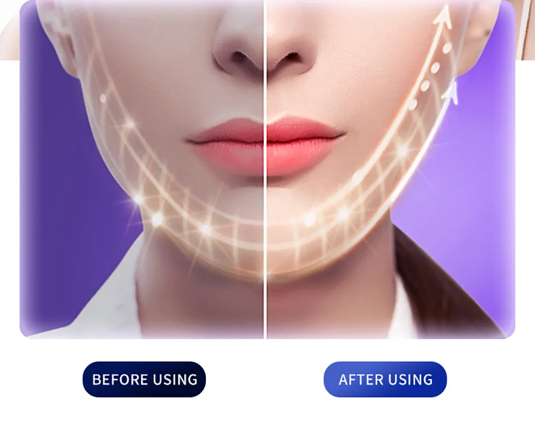 Ultrasonic Face Cleanser Handhold Beauty Device Skin Scrubber