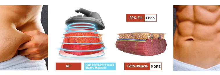 Facial Lift Tecar Therapy Physio Lose Weight 448K Weight Loss Tecar Therapy RF Pain Relief Indeeplus Machine