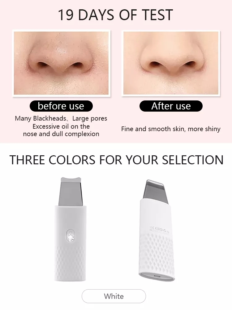 Ultrasonic Face Skin Scrubber Blackhead Acne Removal Facial Vibration Massager Peeling Shovel Exfoliator Clean Machine