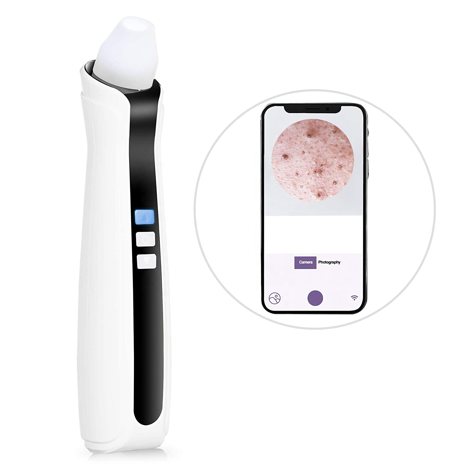 Acne Comedone Extractor Portable Electric 1080P HD Camera 3-Speed Adjustable Pore Vacuum Suction Pore Cleaner Acne Treatment