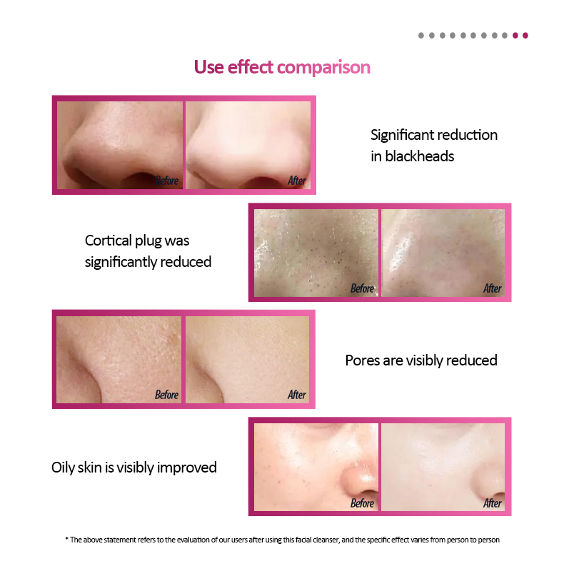 Silicone Face Cleansing Brush Details 7