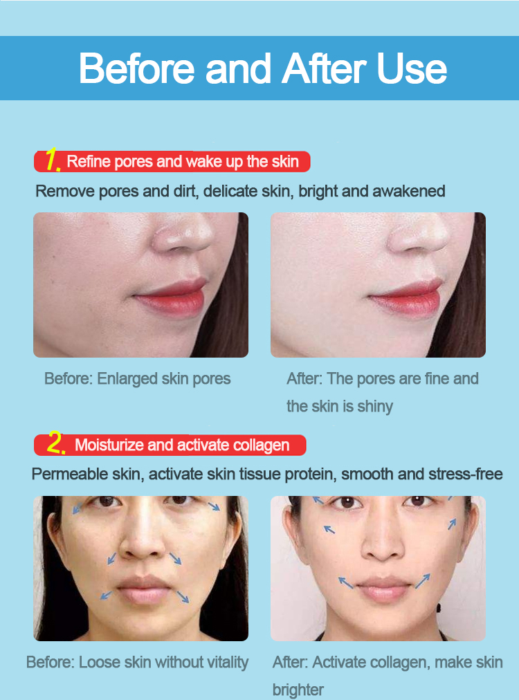 Skincare wand details 8