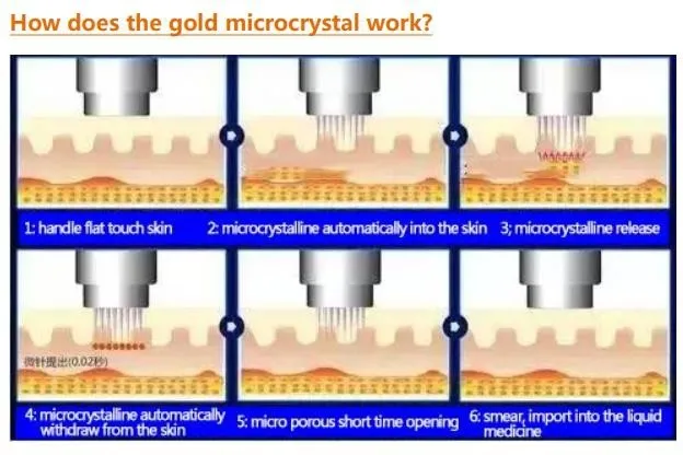 Gold RF-Hifu Microneedle 3-in-1 Facial Treatment Machine