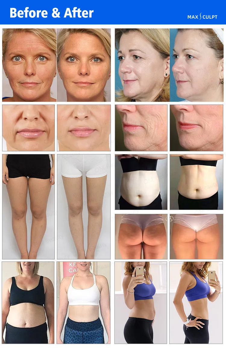 Treatment Result 1