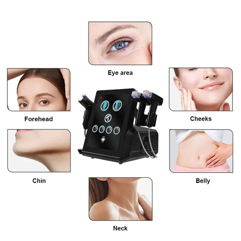 Upgrade Wrinkle Removal RF Microneedling Radio Frecuent Facial RF Skin Tightening Device