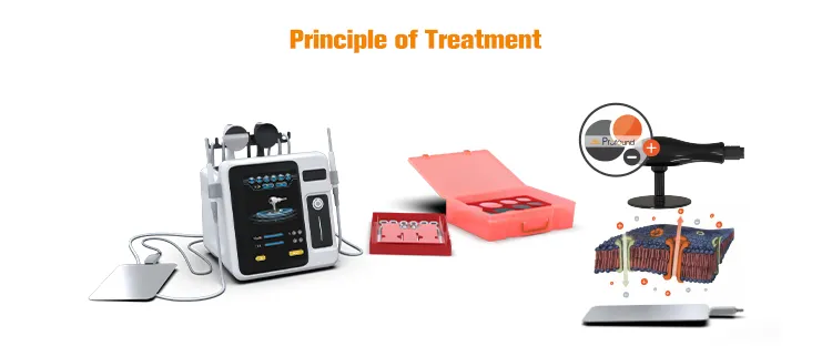 RF Technology Application