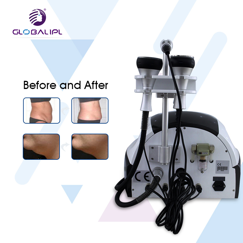 Slimming Machine / RF Vacuum Cavitation Weight Loss Machine Ultrasound Vacuum Machine