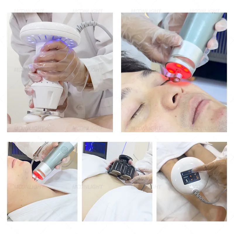 Treatment Result 2