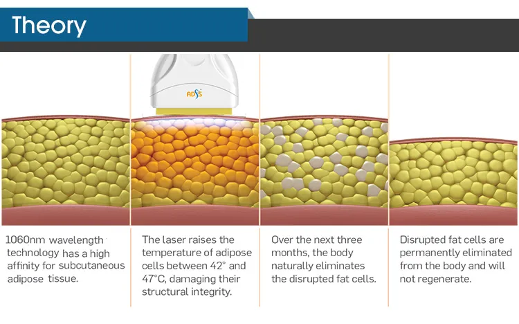 Laser Slimming Technology Detail