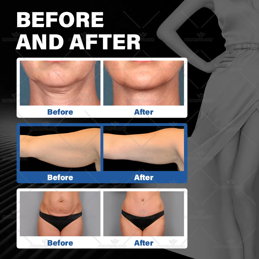 Before and After Results
